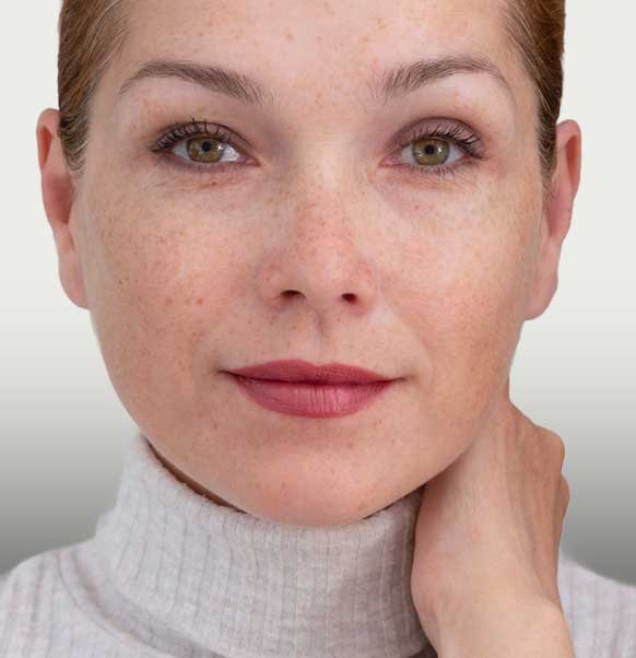 Les taches pigmentaires du visage : un problème frequent