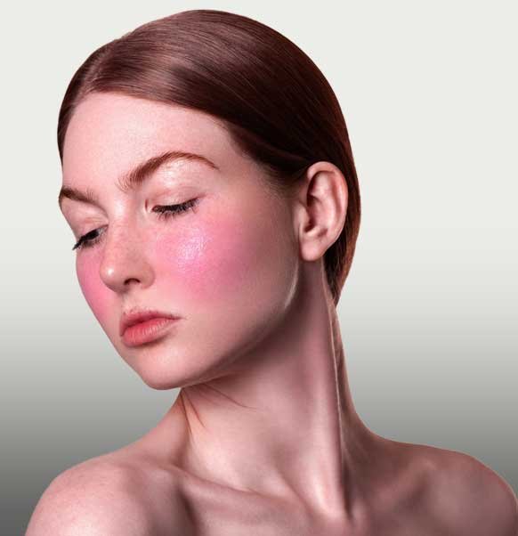 Comprendre les rougeurs du visage : causes et impacts