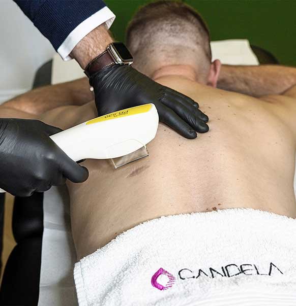 L’IPL Nordlys®, une solution efficace contre les rougeurs du visage à Paris