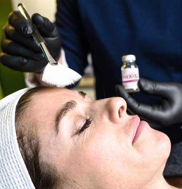 Le peeling PRXT33 au centre KEA à Paris