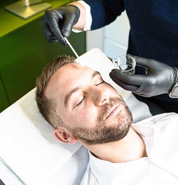 Le peeling au TCA, une solution innovante au centre KEA à Paris