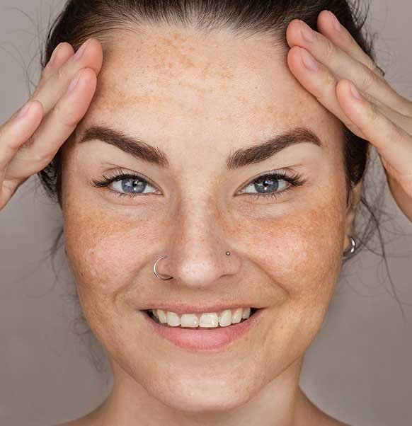 Prise en charge des taches pigmentaires pendant la période hivernale