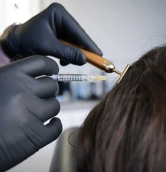 Injections capillaires à Paris – Dr CYJ Hair Filler®