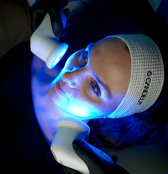 soin GLACĒ™ au centre de médecine esthétique KEA à Paris